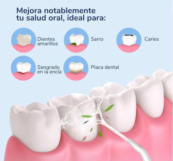 LIMPIADOR DENTAL, IRRIGADOR ORAL RECARGABLE