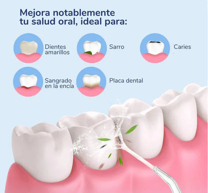LIMPIADOR DENTAL, IRRIGADOR ORAL RECARGABLE